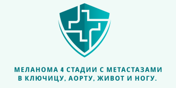 Отзыв об Ивермектине и Фенбендазоле. Меланома 4 стадии с метастазами в ключицу, аорту, живот и ногу. Из писем доктору У. Макису.   